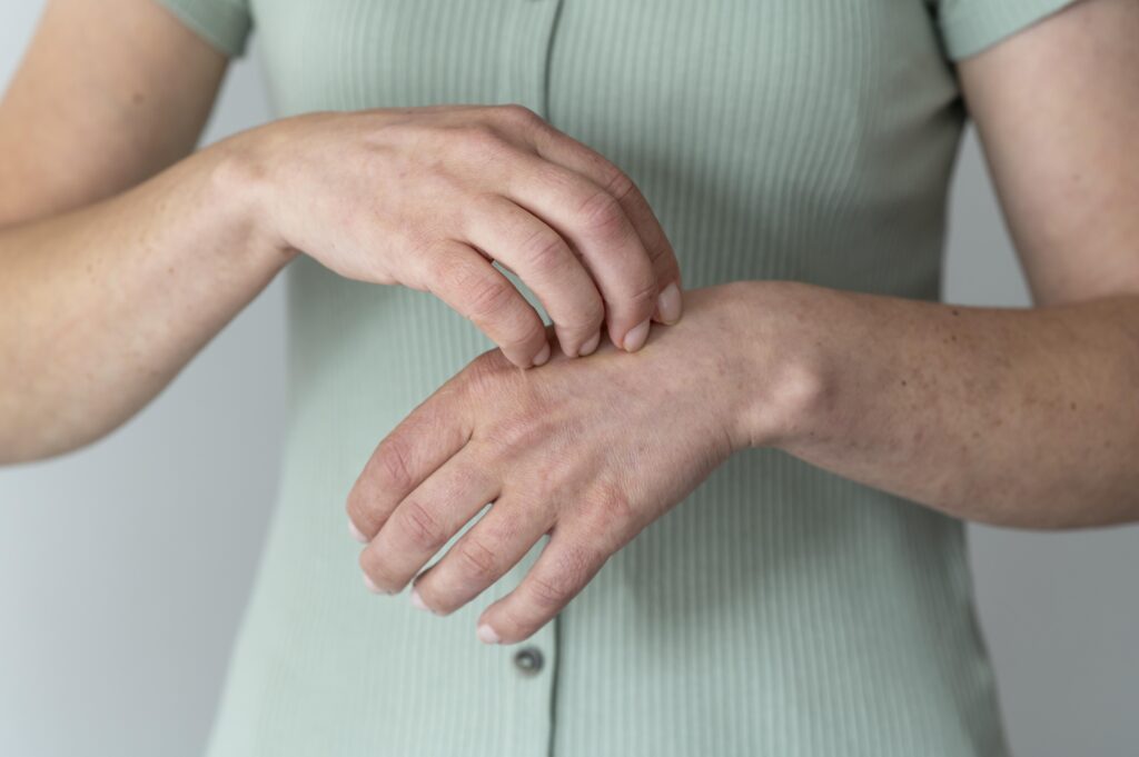 Mujer con alergia en la piel, rascando con la mano, dermatitis atópica