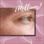 ¿Que son los miliums en la piel?